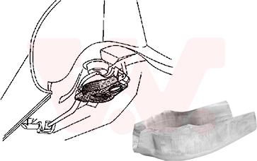 Van Wezel 3755499 - Mudguard car-mod.net